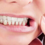 Kişiye Özel Ortopedik Tabanlıklar: Diş Sıkma ve Çene Problemlerine Çözüm mü?