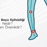 Bacak Boyu Eşitsizliği Nedir? Neden Önemlidir?