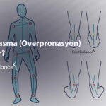 İçe Basma (Overpronasyon) Nedir?
