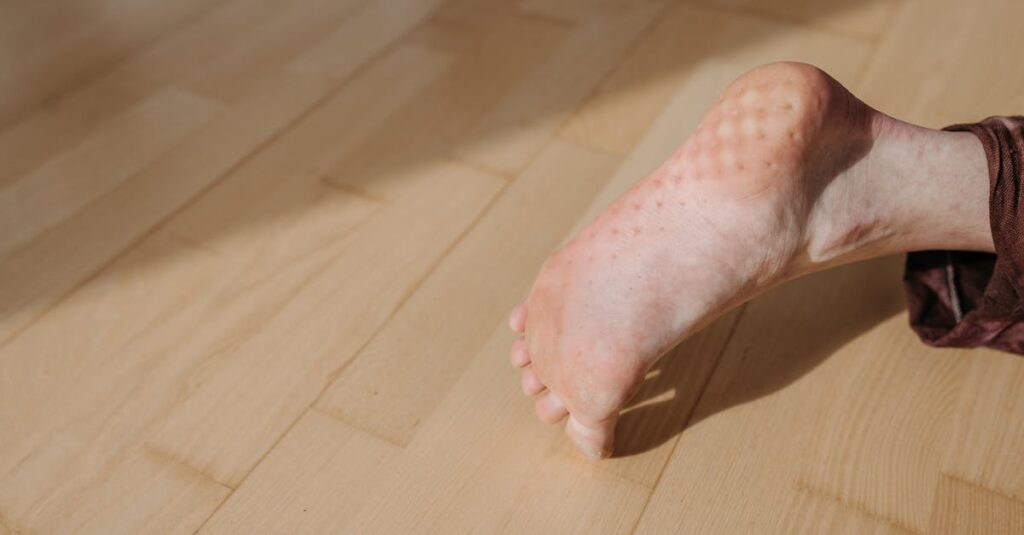 Halluks Valgus Tabanlik Secimi